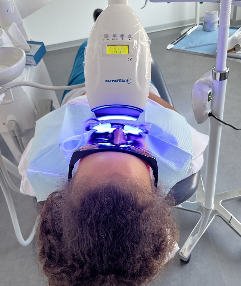 Primer plano de un paciente tumbado en el silla de la clínica dental durante el tratamiento de blanqueamiento dental.