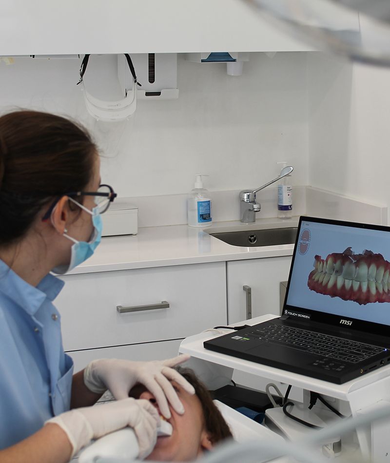 Camino utilizando un escáner intraoral.
