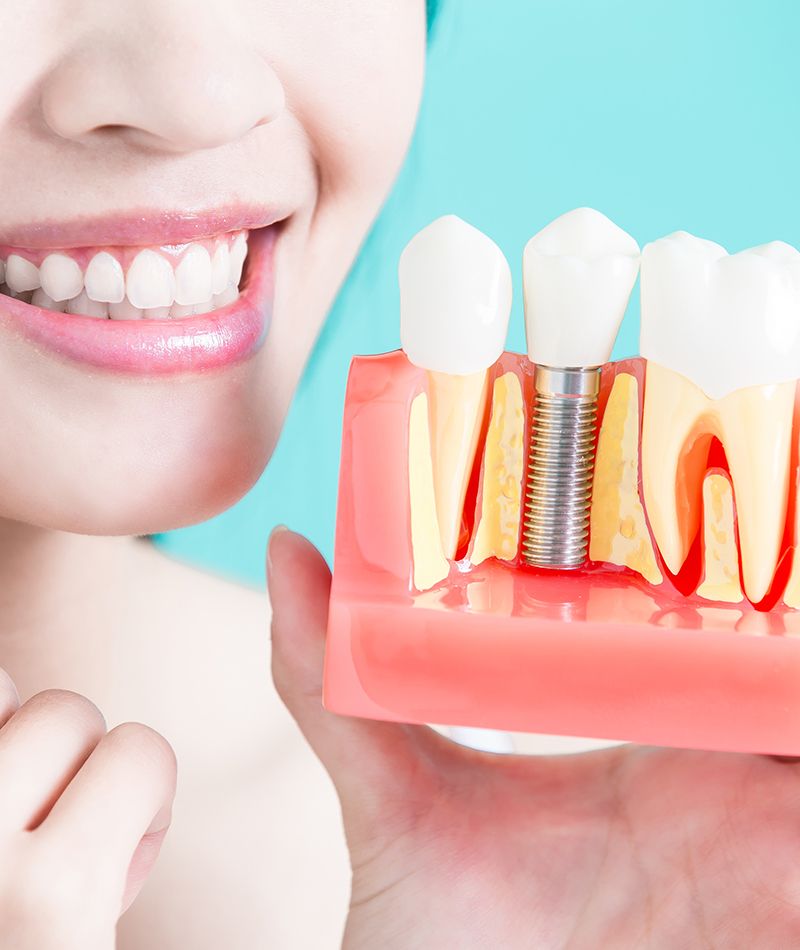 Chica sosteniendo un molde con un implante dental.
